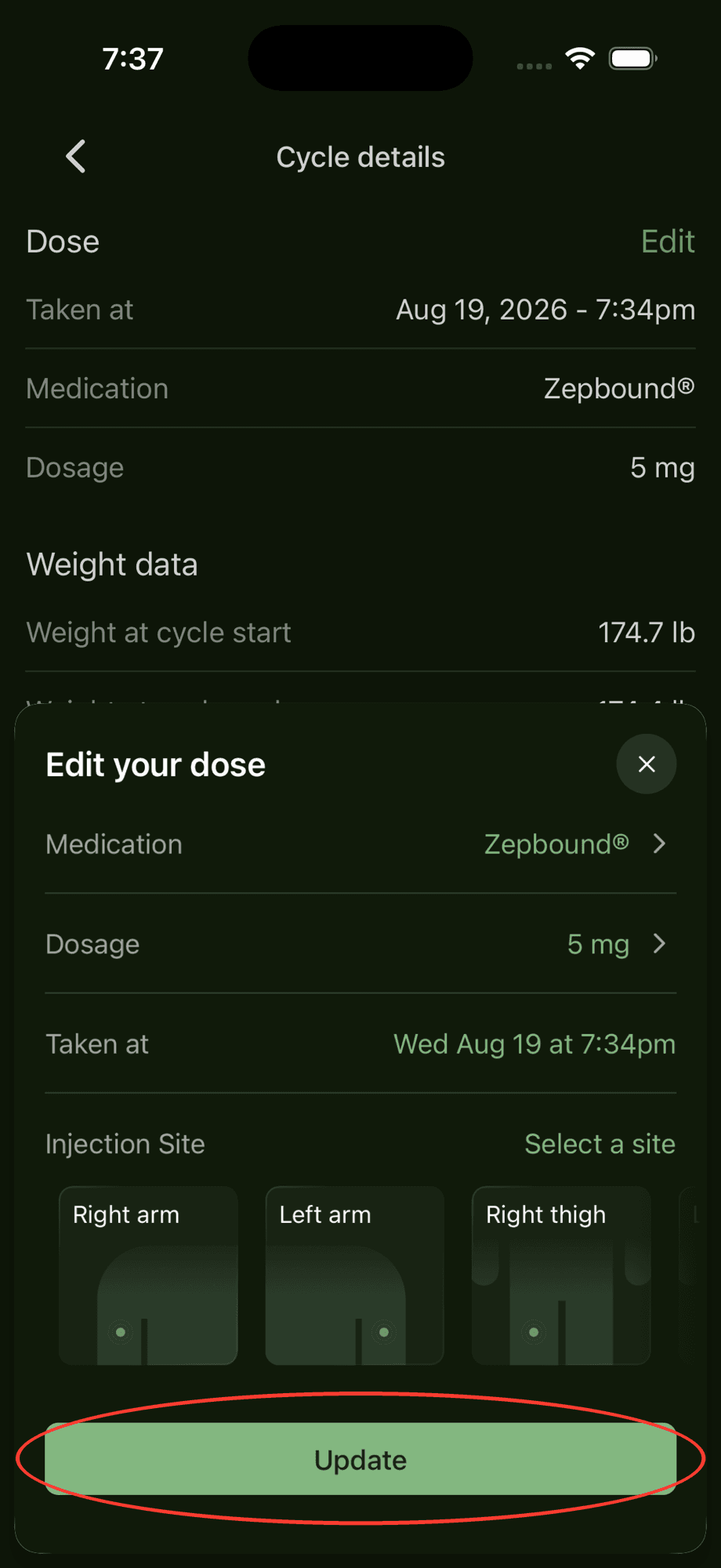 Edit your dose sheet with the Update button circled